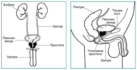 prostate editor_1