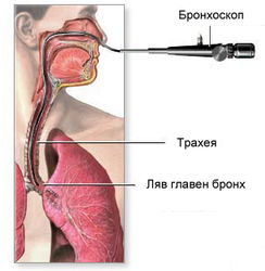 bronchoscopy-copy