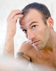 manbalding_186a_081808